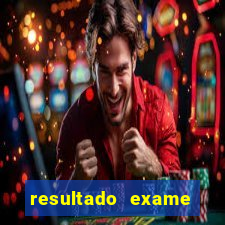 resultado exame eliel figueiredo